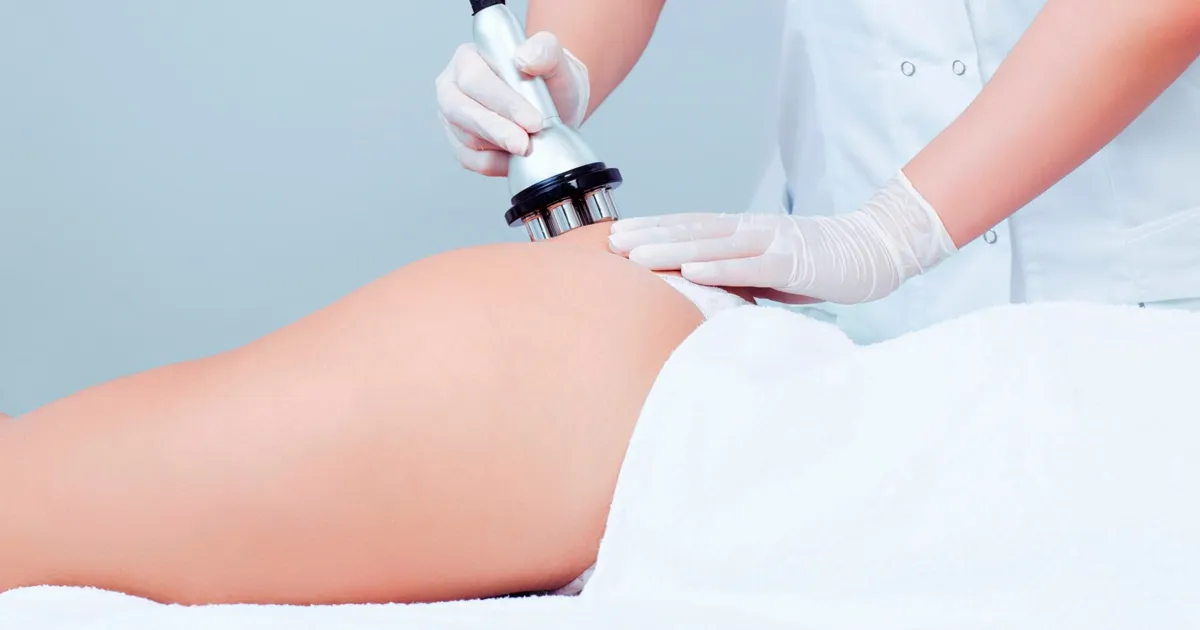 Tratamiento corporal con radiofrecuencia en una clínica de medicina estética